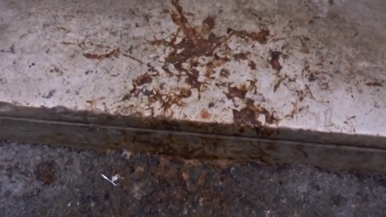 vomito